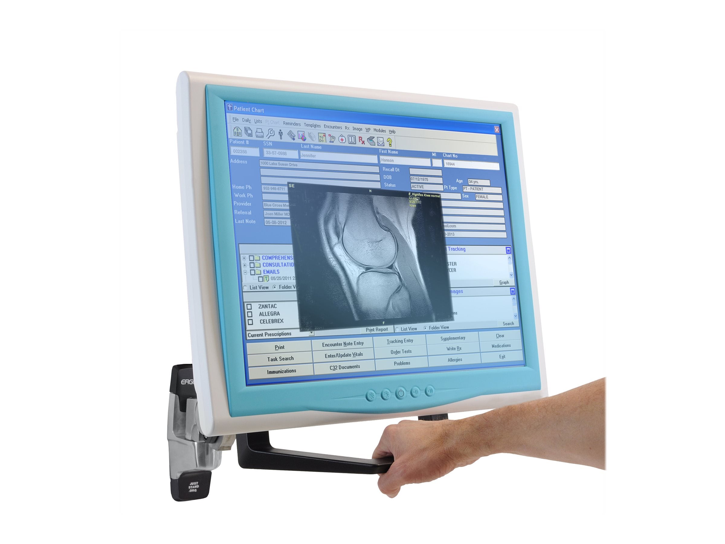 ERGOTRON Monitor Griff Kit Montagekomponenten